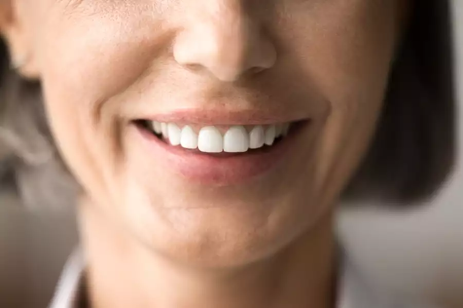 Closeup of older woman smiling after All-on-X Dental Implants